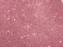 FLY FOAM GLITTER hotfly - 2,0 mm - 2 pc. - pink